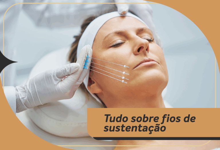 Tudo o que você precisa saber sobre os fios de sustentação!