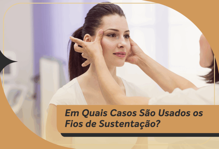 Em quais casos são usados os fios de sustentação?