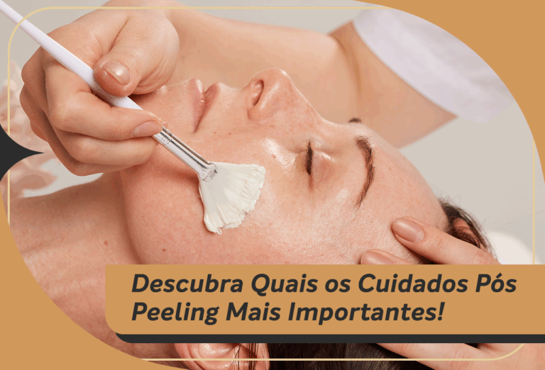 Descubra Quais os cuidados pós peeling mais importantes!