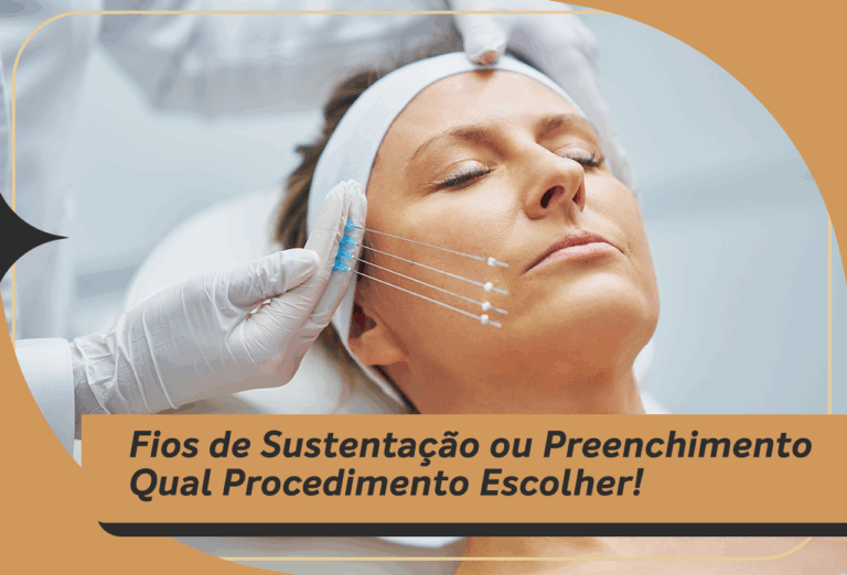 Fios de sustentação ou preenchimento qual procedimento escolher!