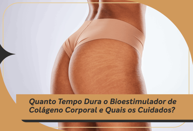 Quanto tempo Dura o Bioestimulador de colágeno corporal e quais os cuidados?