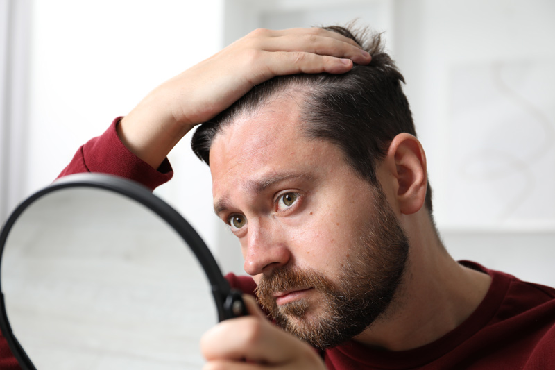 Homem observando cabelo caindo muito
