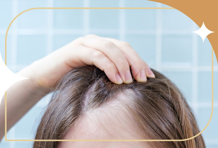 Queda de cabelo: quando é hora de procurar tratamento?