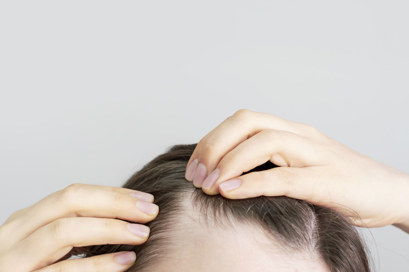 Entendendo as causas da queda de cabelo