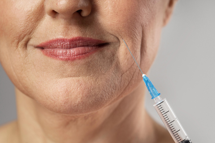 Seringa de aplicação de botox em frente rosto feminino sorridente.