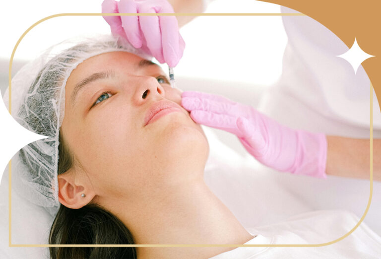 Botox é permanente? Saiba o que esperar do procedimento