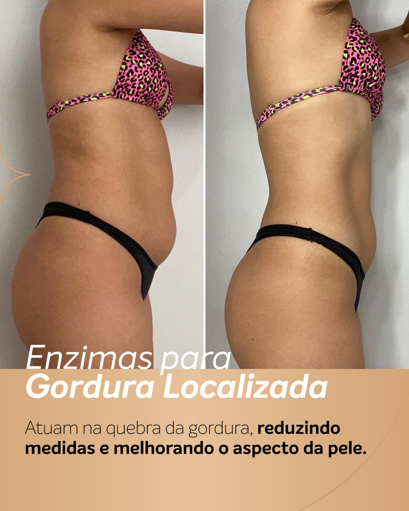 Antes e depois de enzimas na barriga em vista lateral, mostrando redução de medida abdominal e contorno da cintura mais definido.