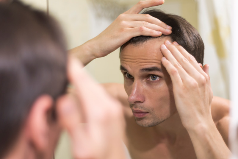 Homem jovem analisando queda de cabelo a partir das entradas.